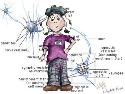 Zambesi - I think you need a new brain!